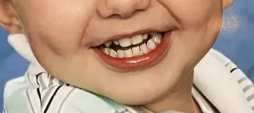 Troy Family Dental PLLC