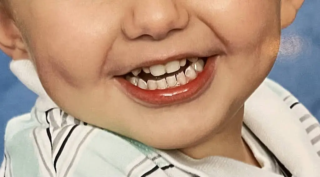 Troy Family Dental PLLC
