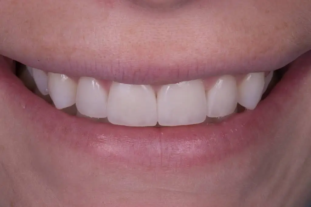 Olive Way Dental