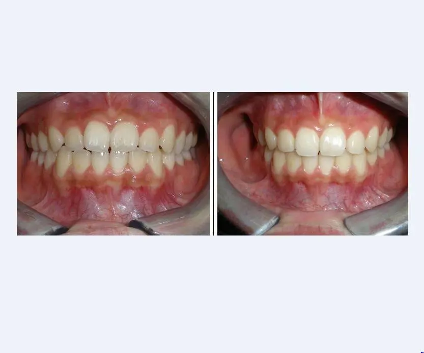 Burien Family Dental Care