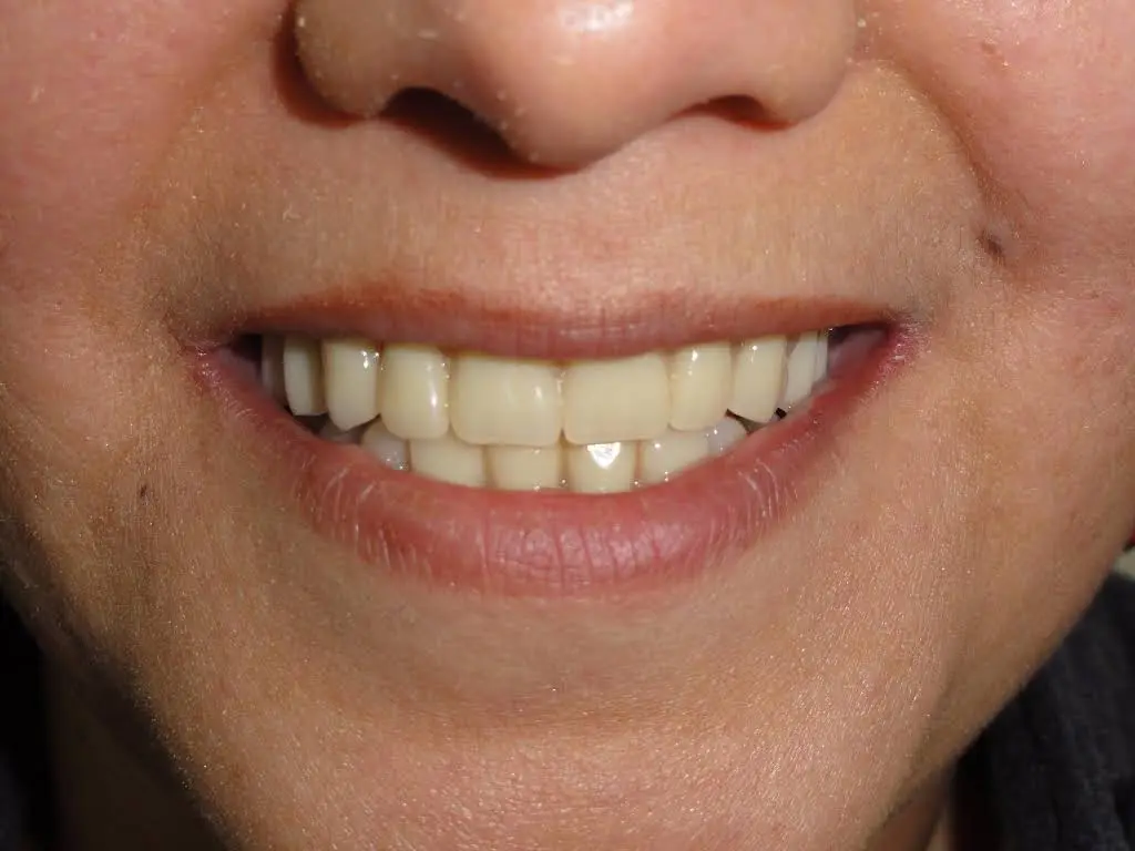 Beautiful Smiles Denture and Dental Clinic