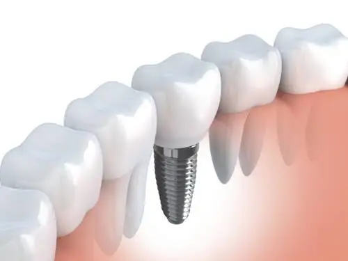 Goldwire Dental