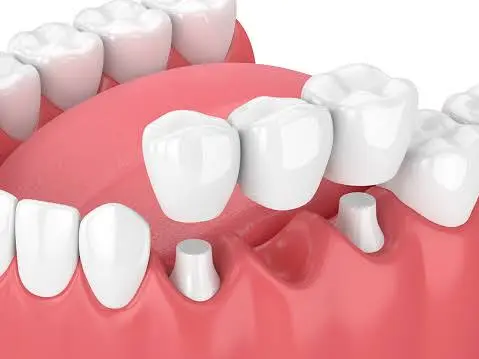 Goldwire Dental