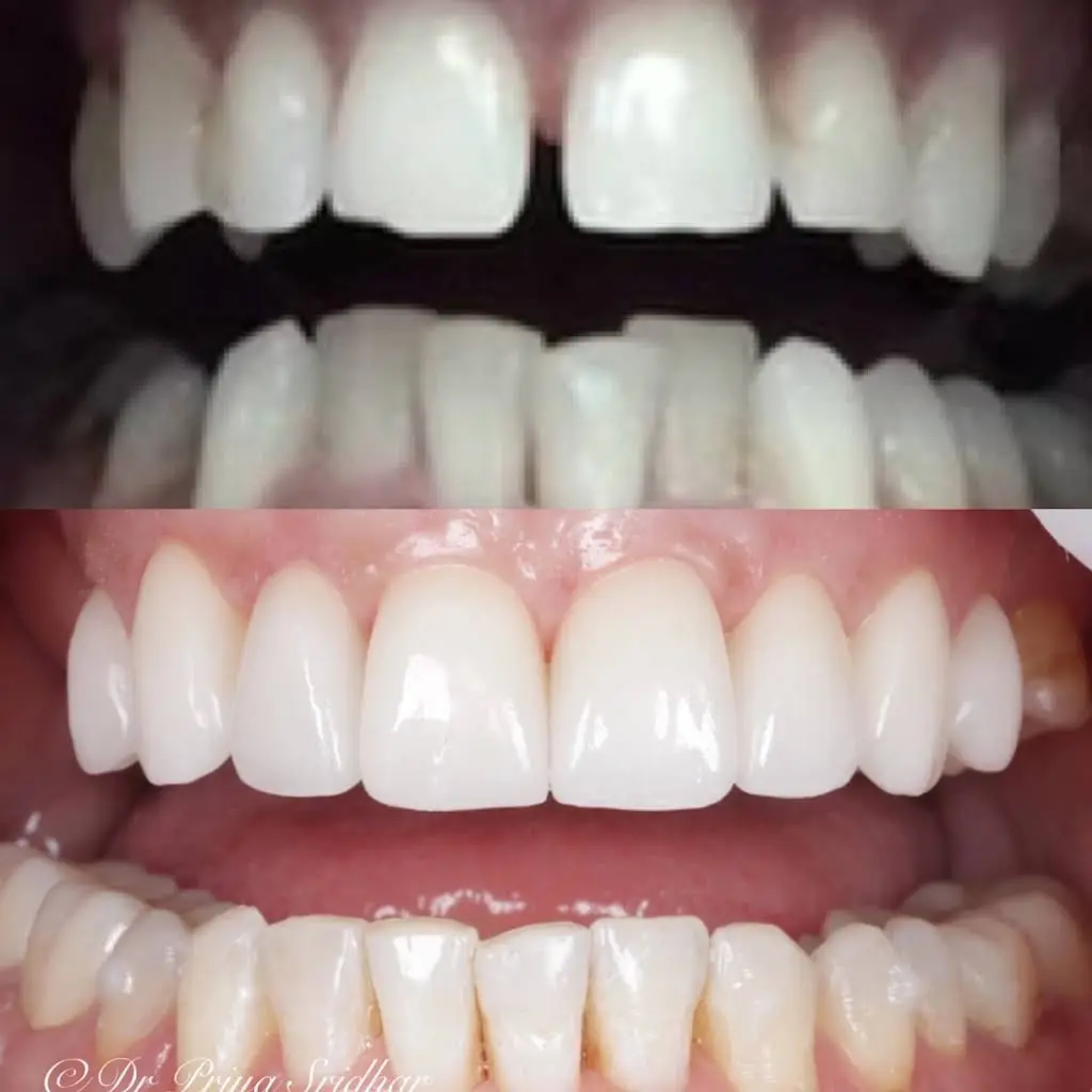 Kenmore Dental