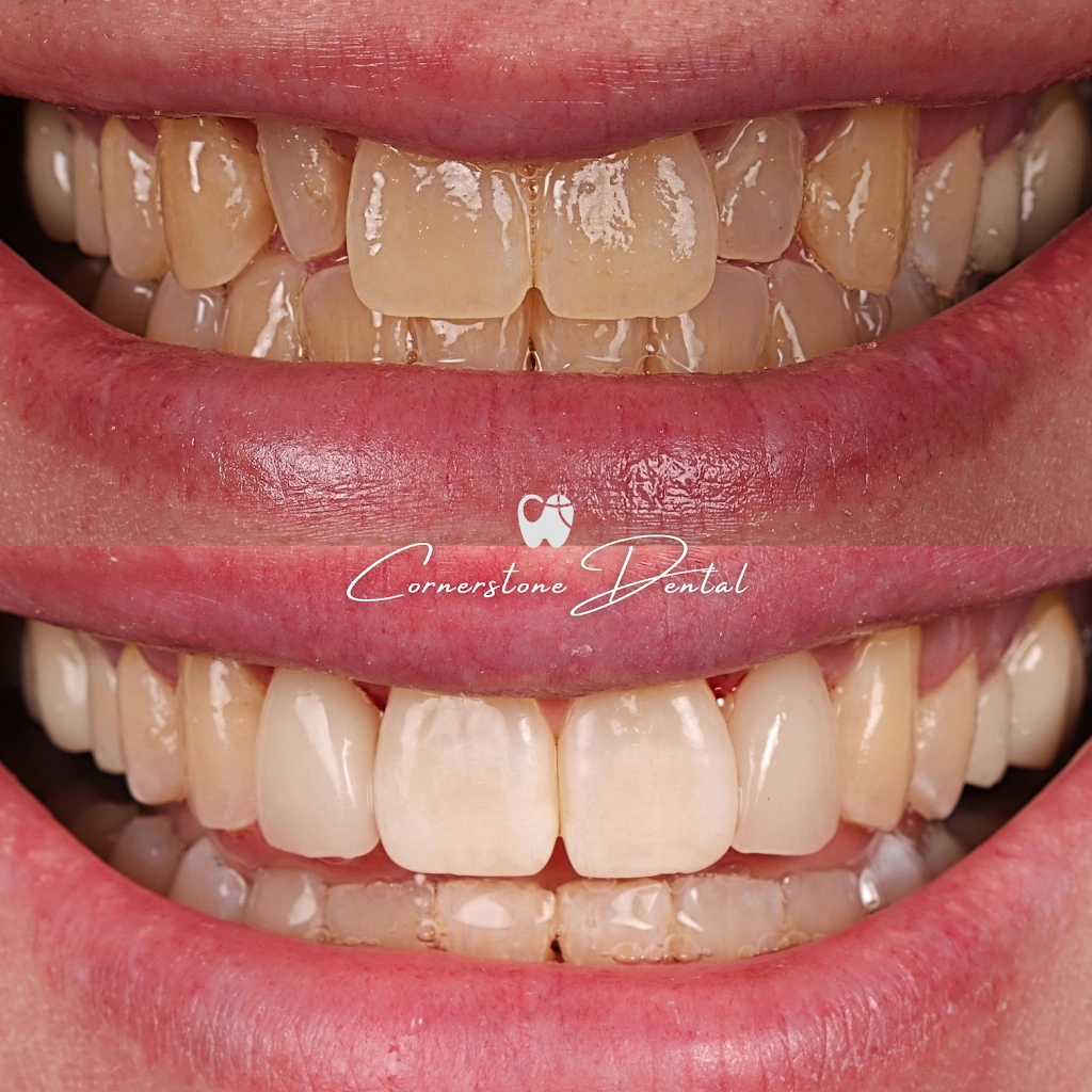 Kirkland Cornerstone Dental