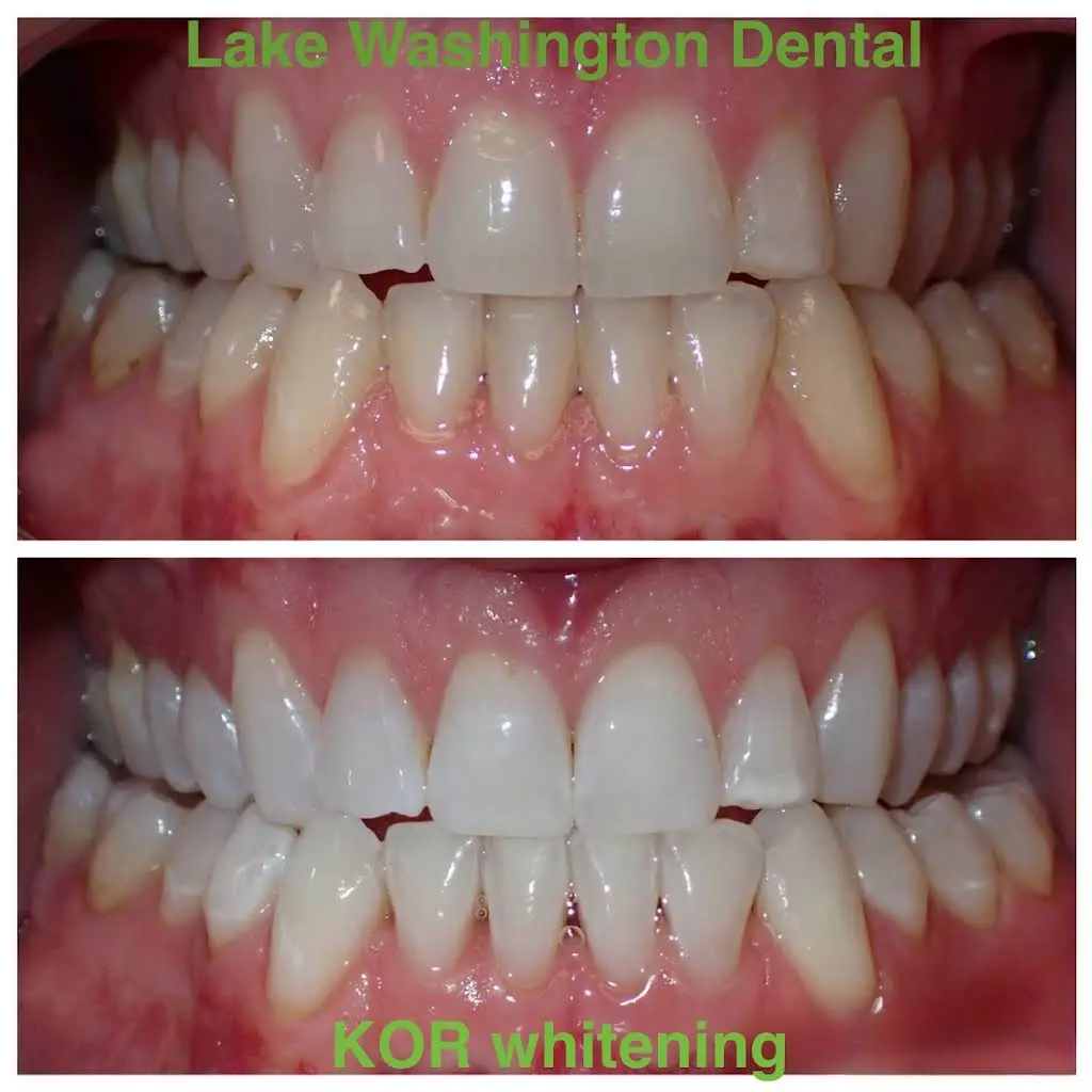 Lake Washington Dental