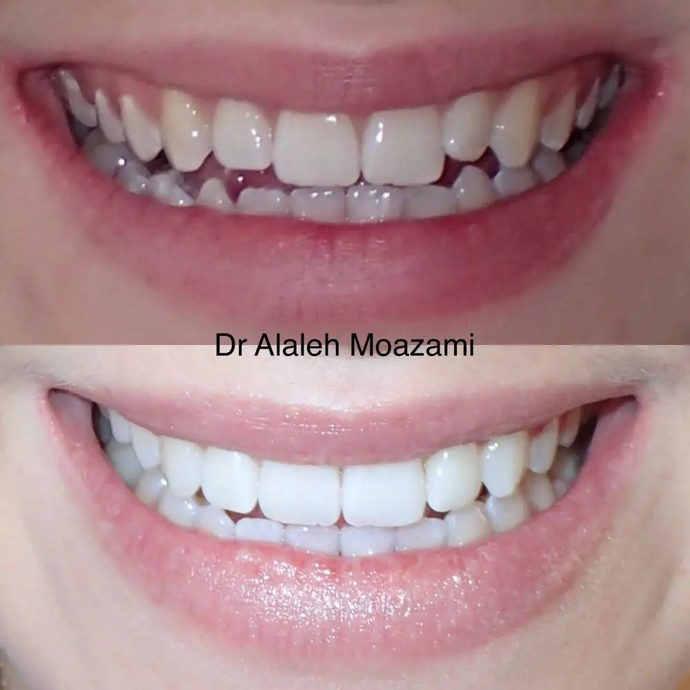 Lake Washington Dental
