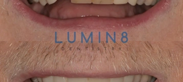 Lumin8 Dentistry
