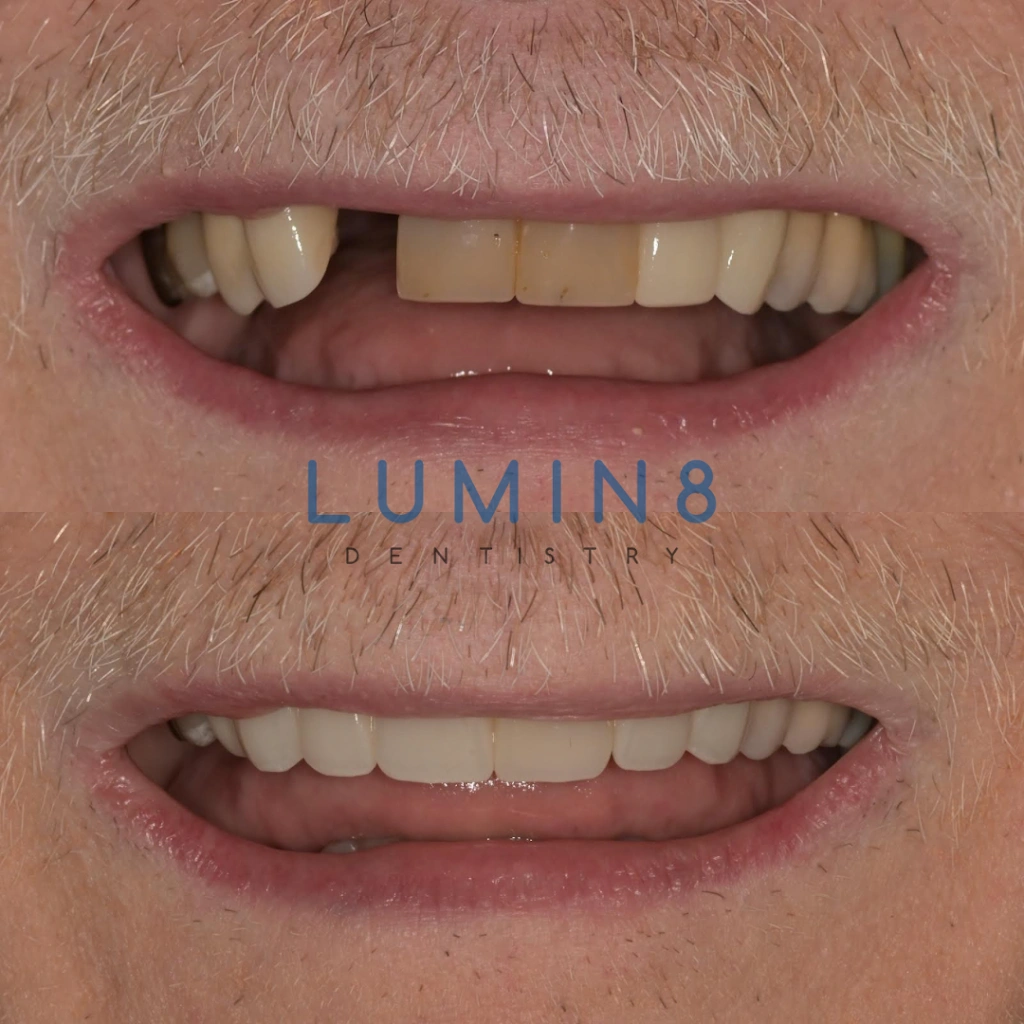 Lumin8 Dentistry