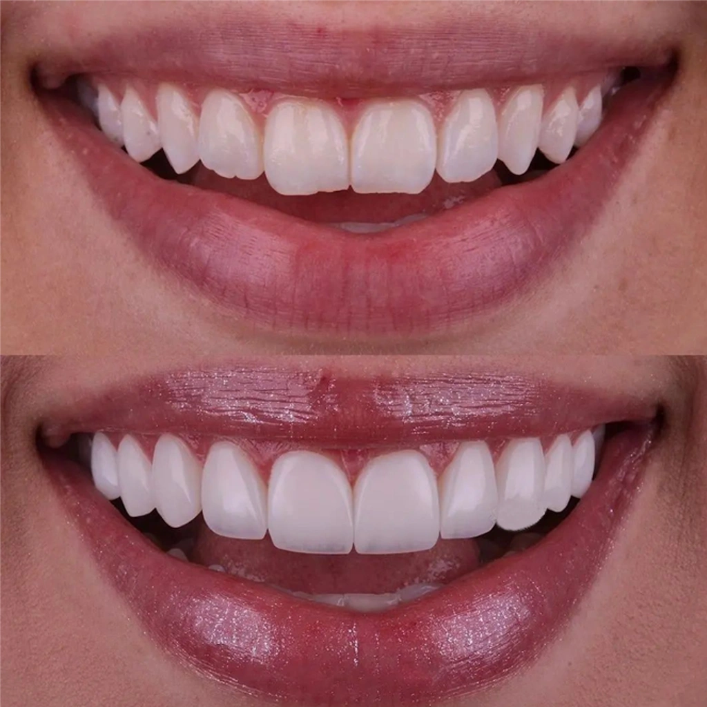 Puyallup Summit Dental Center