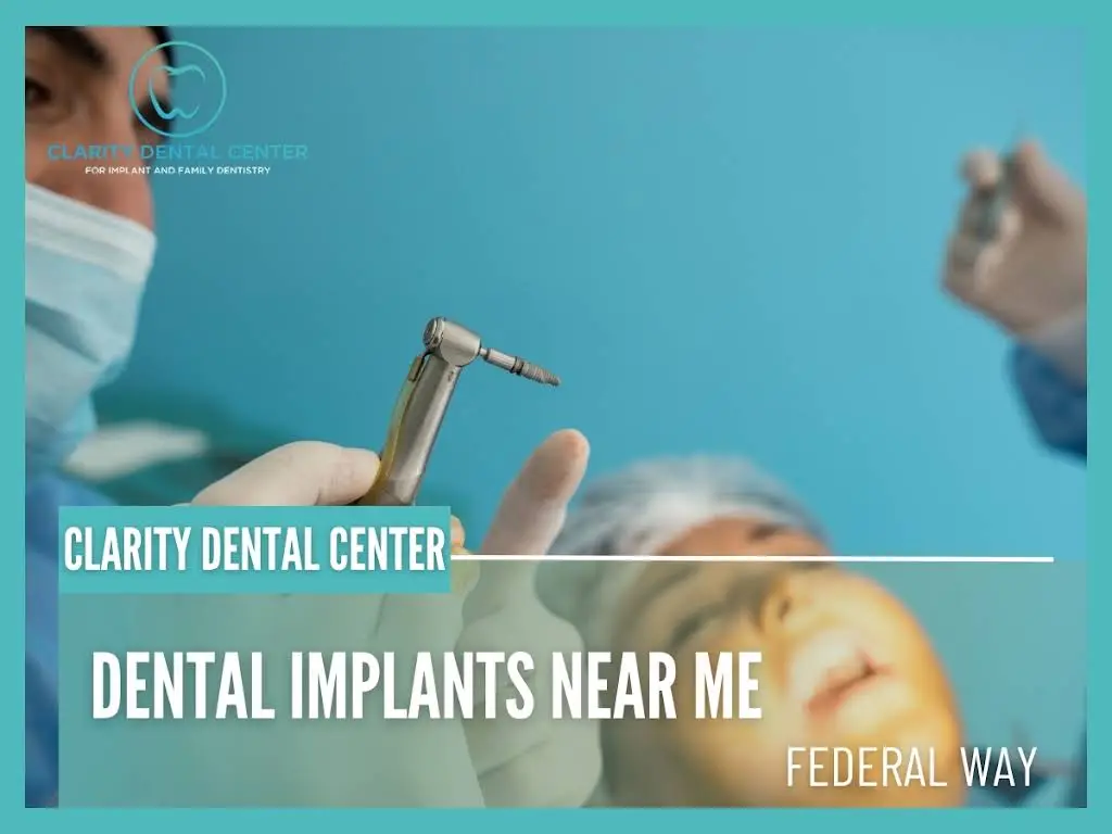Clarity Dental Center for Implant and Family Dentistry