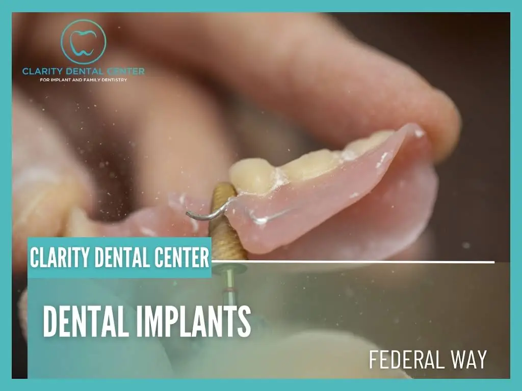 Clarity Dental Center for Implant and Family Dentistry