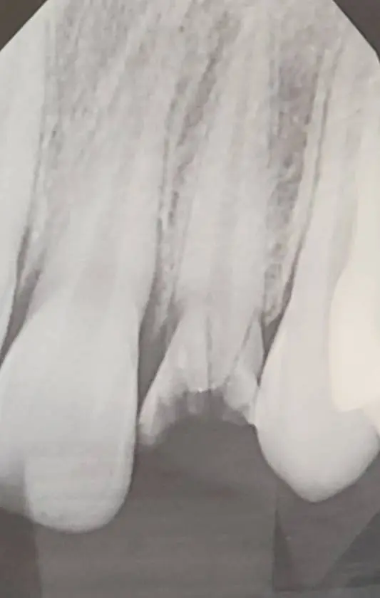 Bright Now! Dental & Implants
