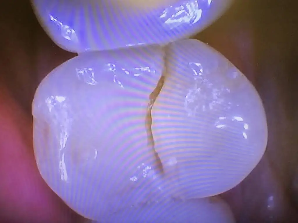 Advanced Dental Services