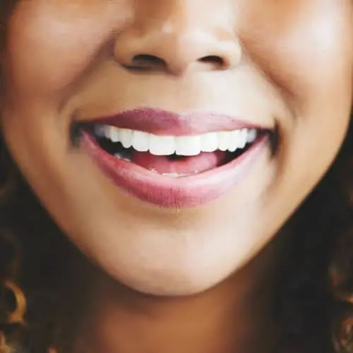 Love Your Smile