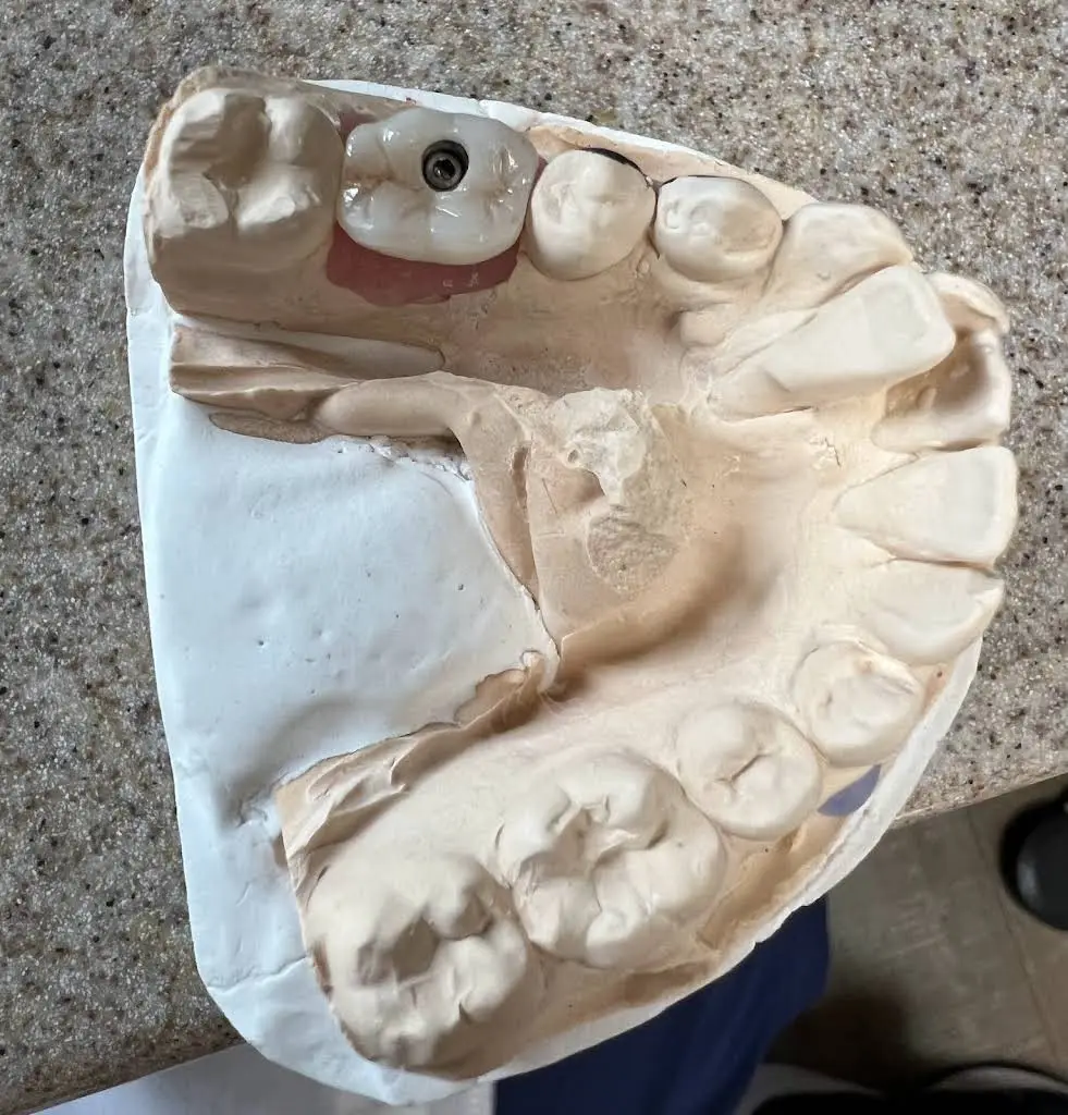 Silver Firs Family & Implant Dentistry
