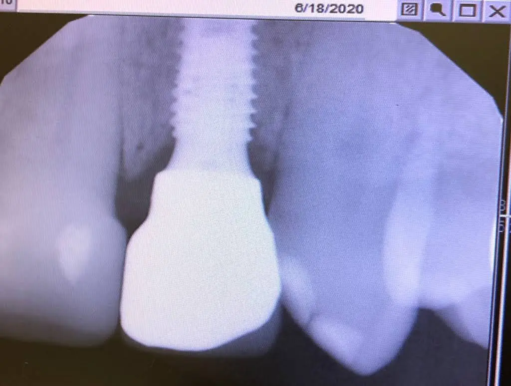Silver Firs Family & Implant Dentistry