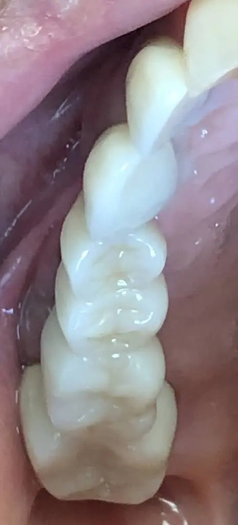 Silver Firs Family & Implant Dentistry