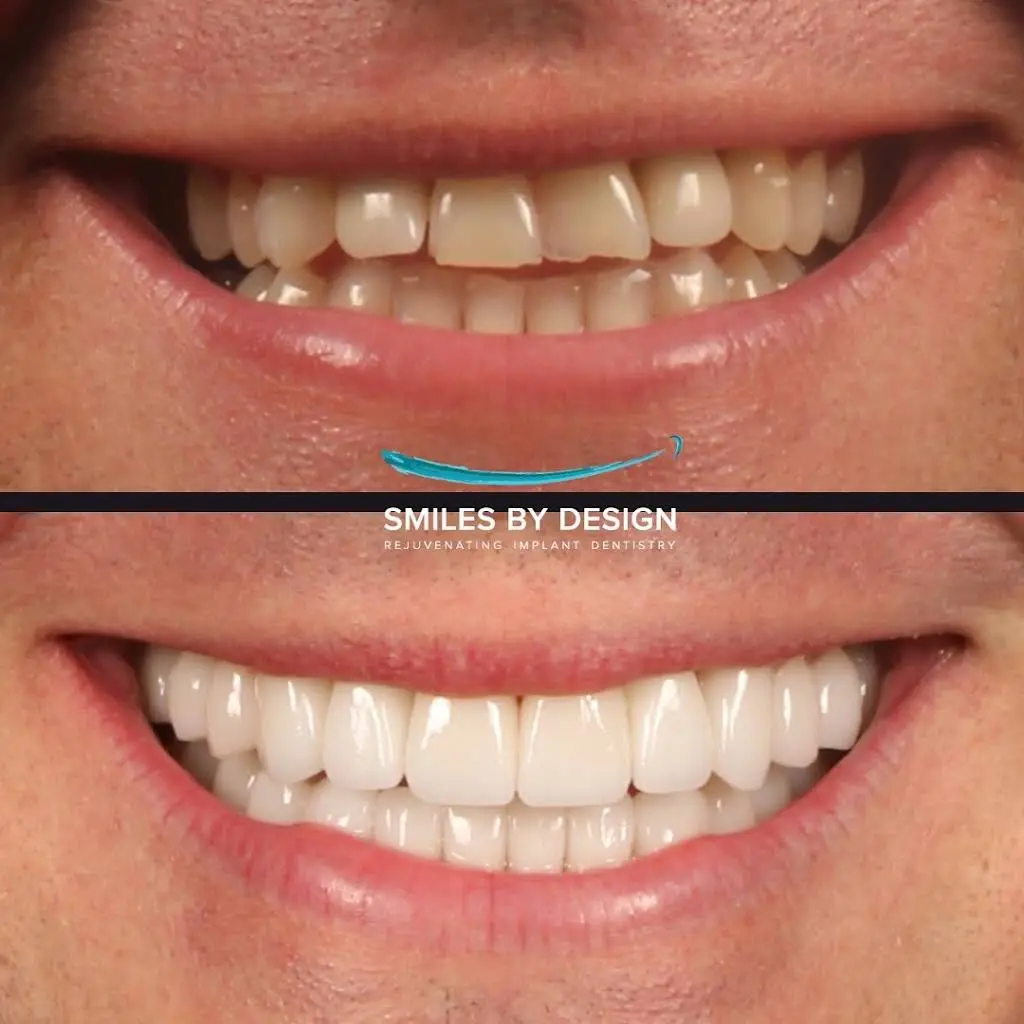 Smiles By Design - Rejuvenating Dentistry