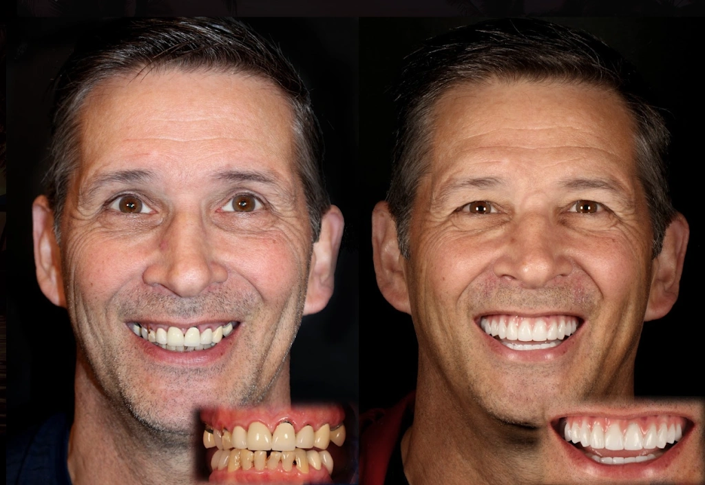 Smiles By Design - Rejuvenating Dentistry