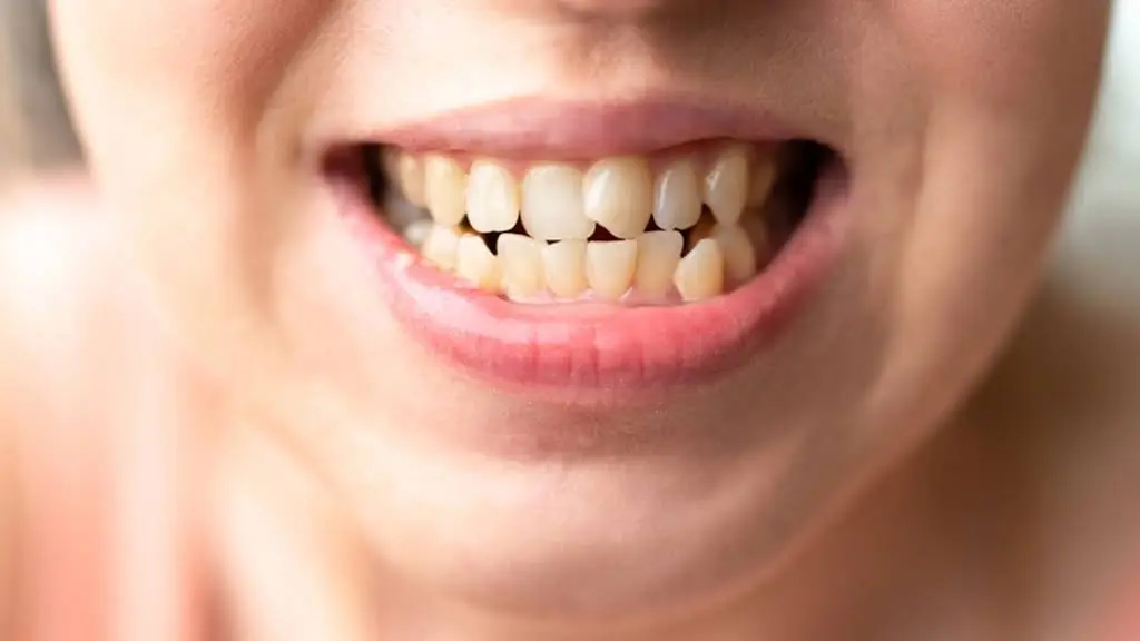 Terrace Creek Dental Care