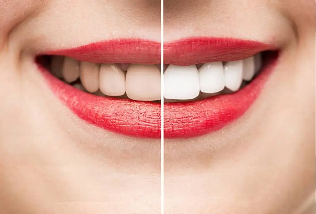 Angel Smiles Dentistry