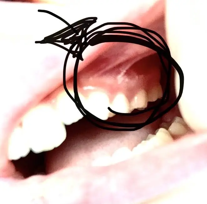Pediatric Dental Associates