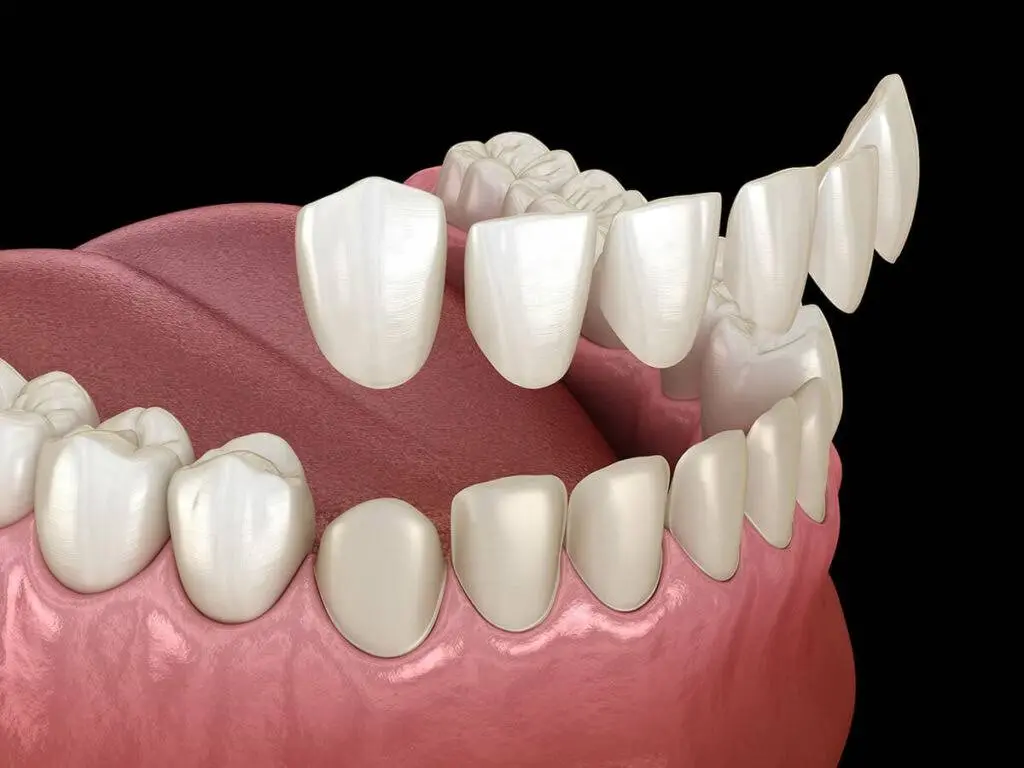 Tacoma Dental Care