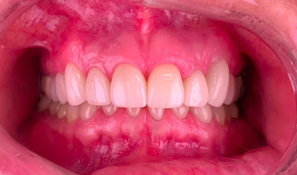 Parkland Smile Dental
