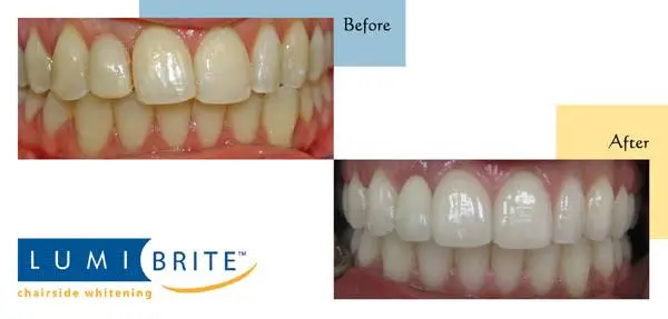 White River Family Dentistry
