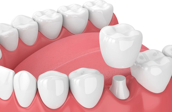 Puyallup Valley Dental Care