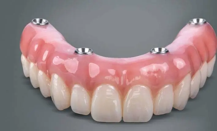 Puyallup Valley Dental Care