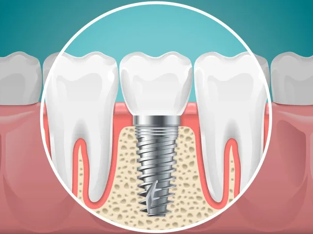 Puyallup Valley Dental Care