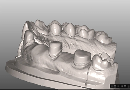 Puyallup Valley Dental Care