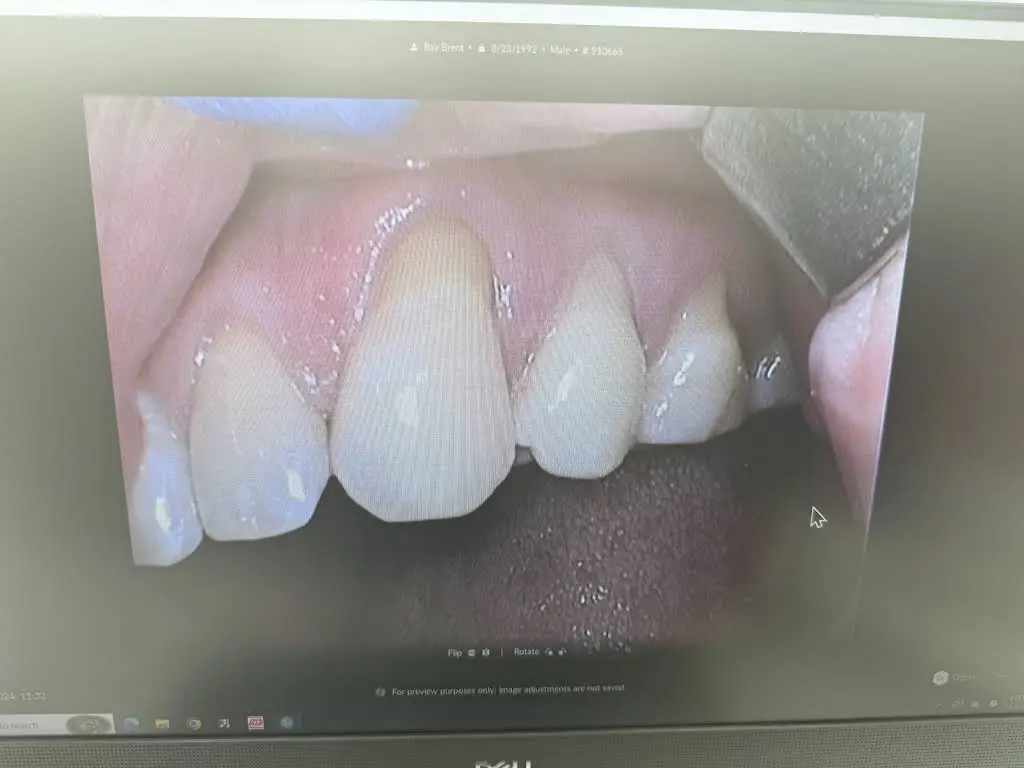 Capitol Hill Seattle Dentist