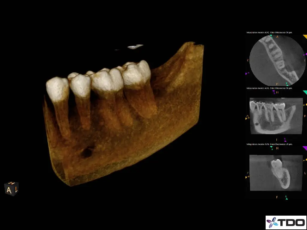 Rainier Endodontics