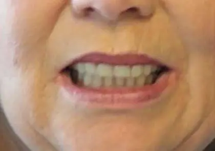 Castle Rock Dental