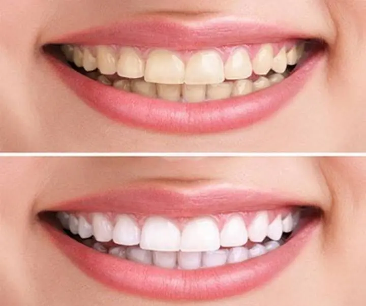 Family Dental Care of Mill Creek: John Szerszen DDS