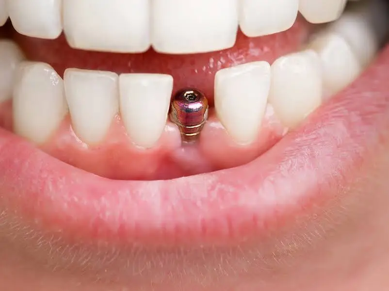 Evergreen Family Dental