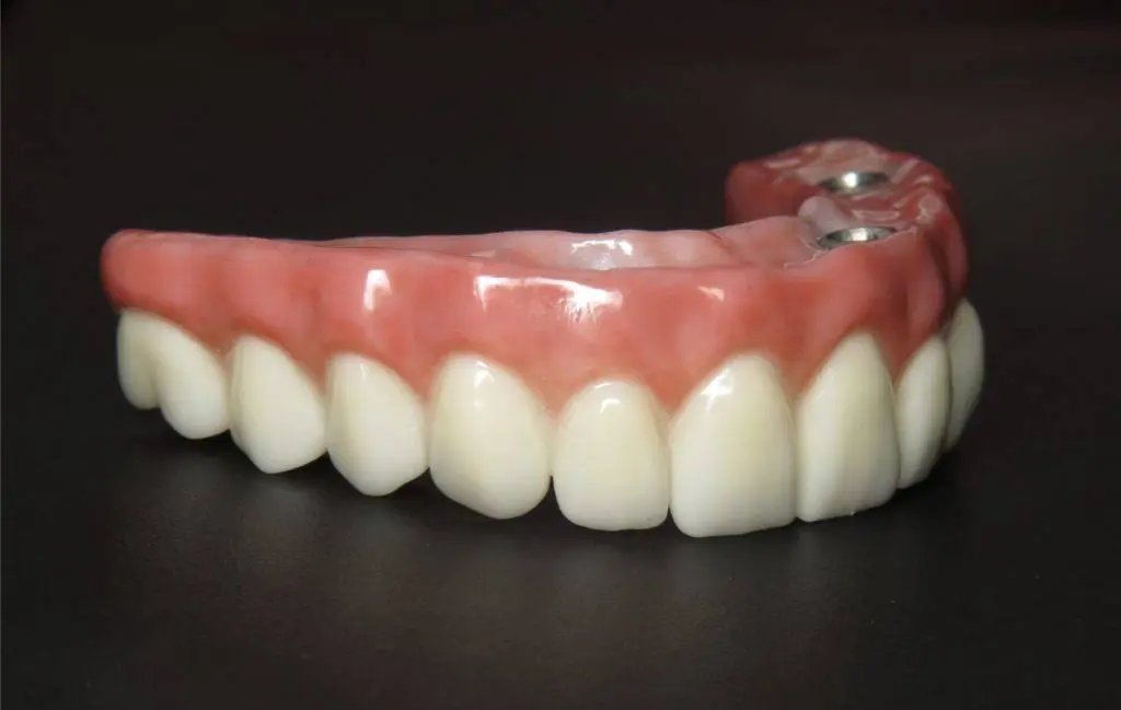 Bismarck Advanced Dental and Implants