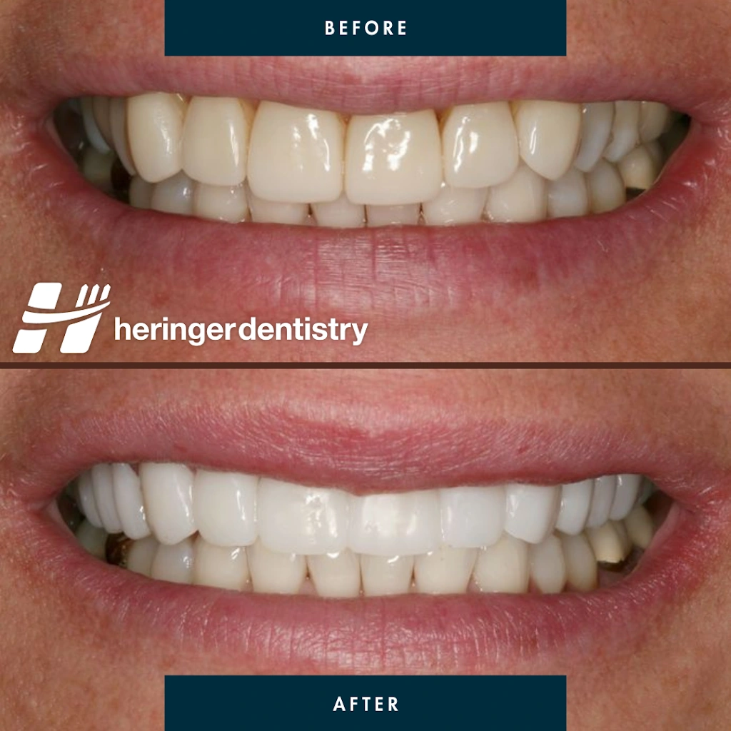 Heringer Dentistry LLC