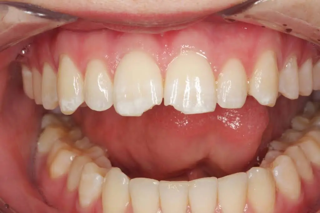 Dentistry In Bellevue