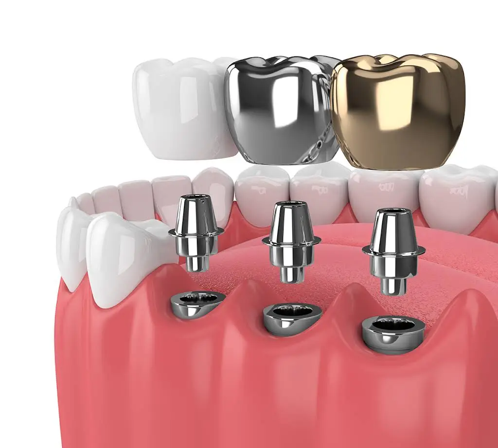 Edmonds Family Dentistry