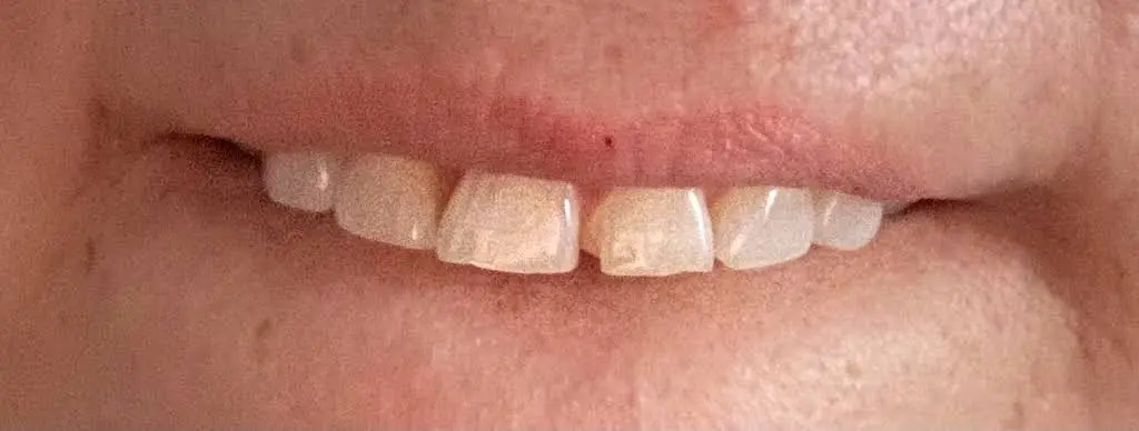 Edmonds Family Dentistry