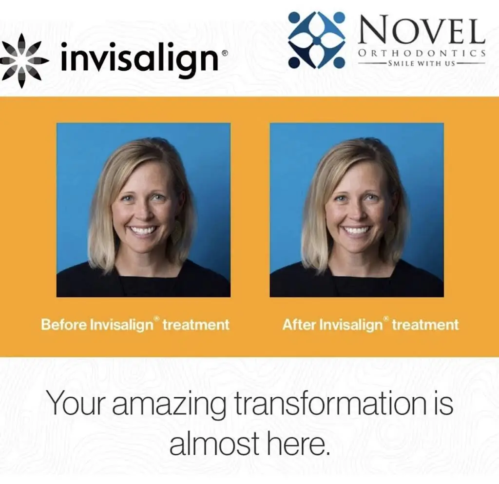 Novel Orthodontics
