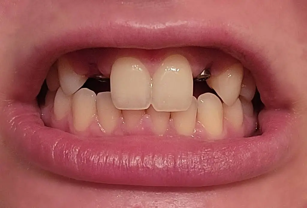 Walker Family Dental