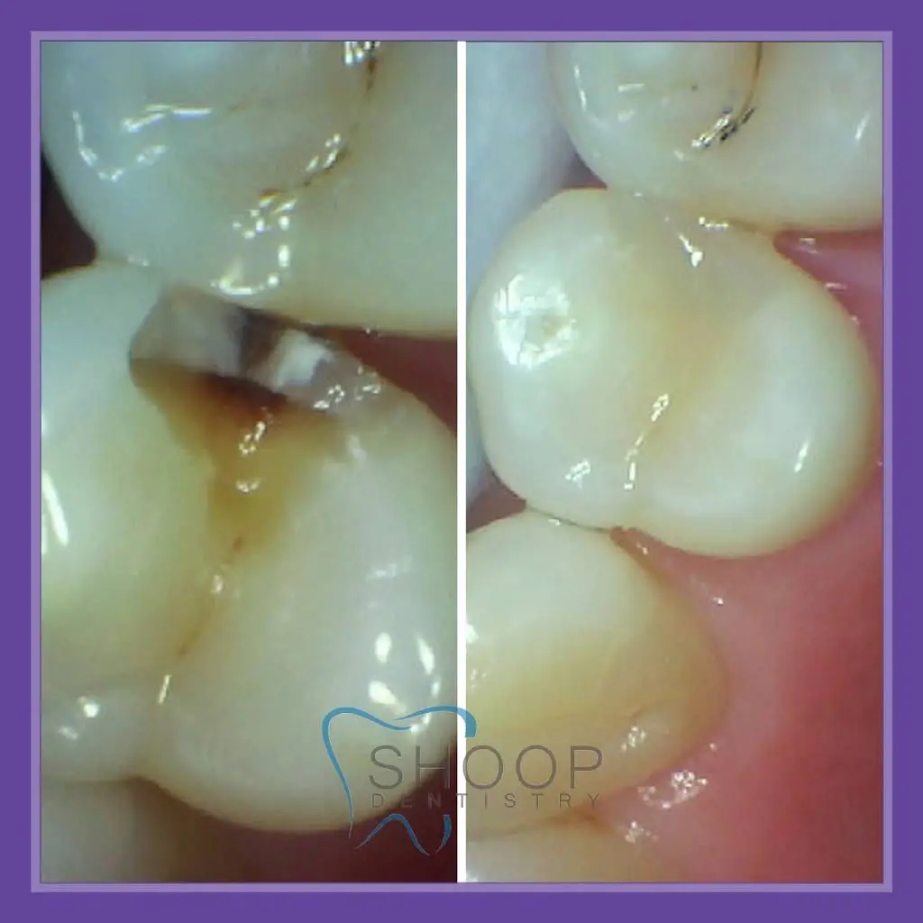 Shoop Dentistry