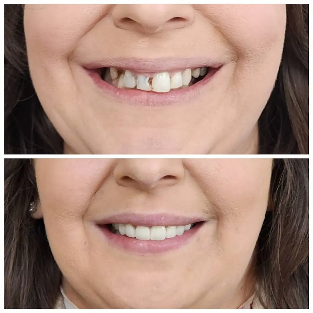 Complete Dental Care of Sumner