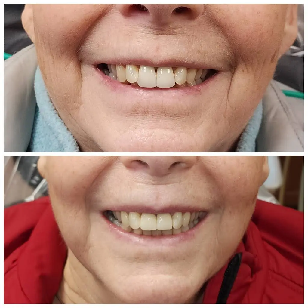 Complete Dental Care of Sumner