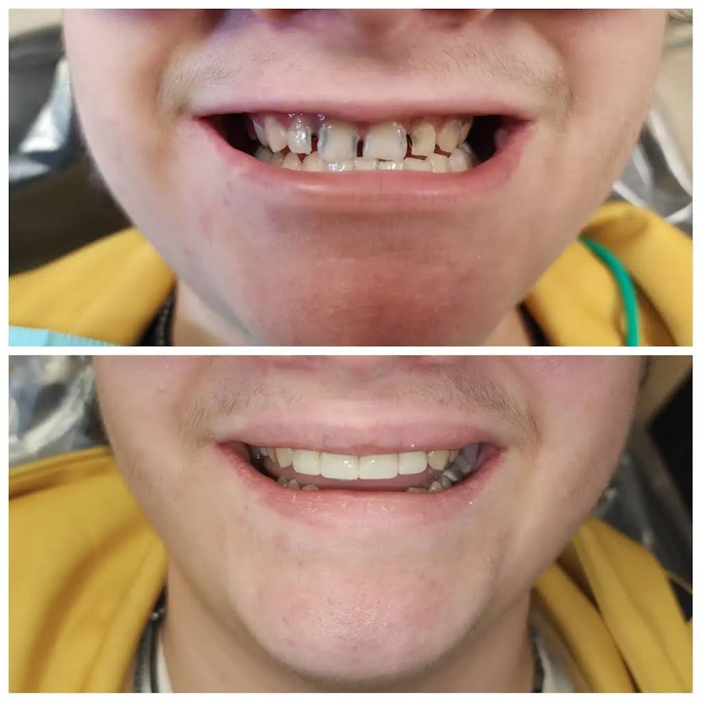 Complete Dental Care of Sumner